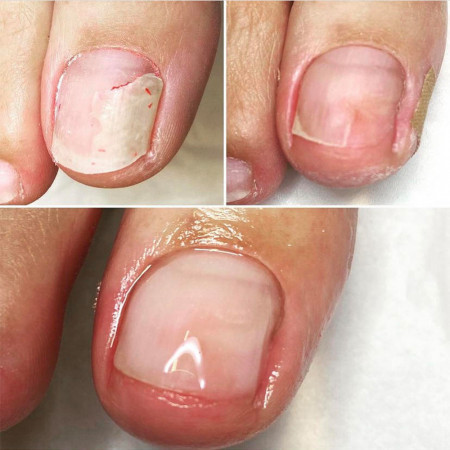 Workshop LCN Wilde Pedique 17 november 2025 DRONGEN Workshop LCN Wilde Pedique 17 november 2025 DRONGEN