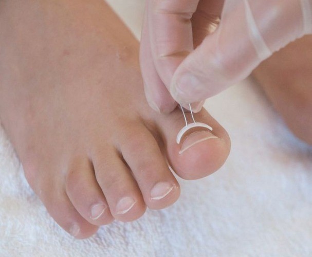 Workshop Podofix 8.06 Drongen