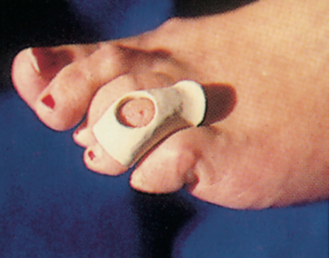 Ortheses maken - cursus 4.02 Harelbeke