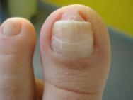 BS Spange Classic nr. 16 par sachet / 10 pièces