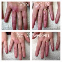 Dadi Oil box 24 stuks